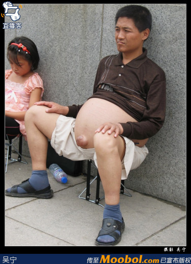 见皮肤病:他的面部,手背与脚上,长满了…