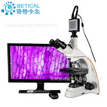 S800T-930HD型三目光學生物顯微鏡高清帶測量拍照纖維細菌微生物