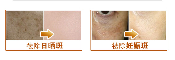 去除晒斑图