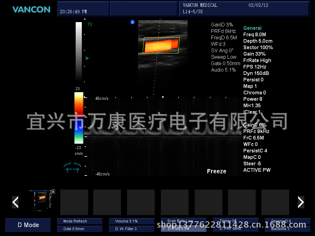 頸動脈頻譜