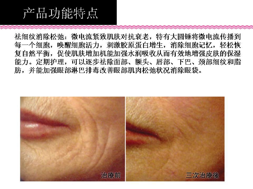 微頻超導瘦面機5