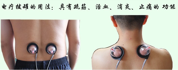拔罐2