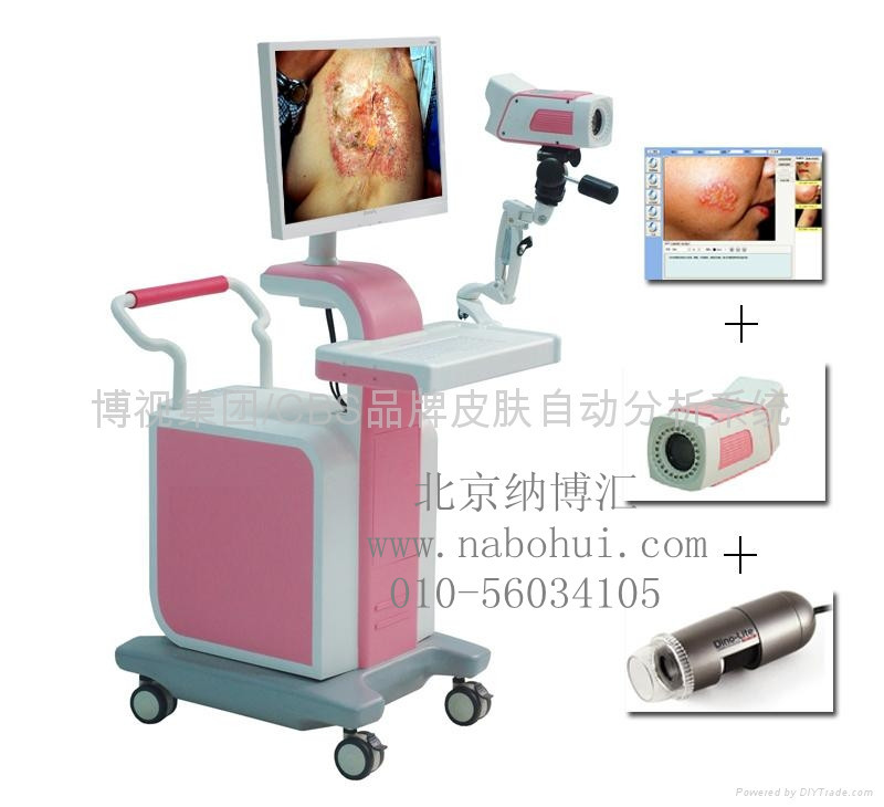 皮肤镜