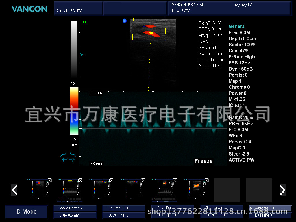 跟腱頻譜