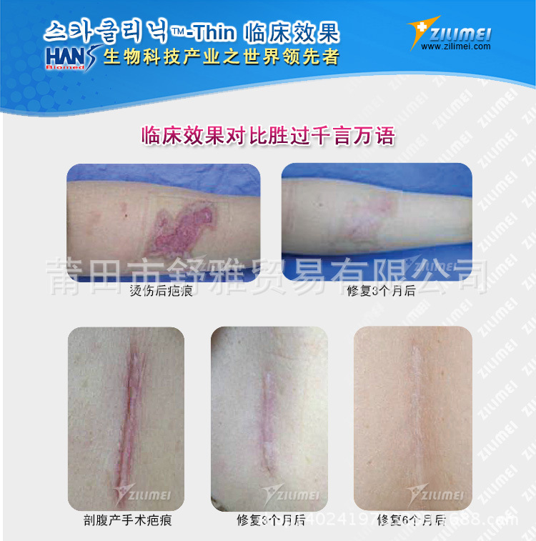 正品韓國Scar Clinic超薄去疤痕貼 燙傷手術剖腹產祛疤痕修復貼