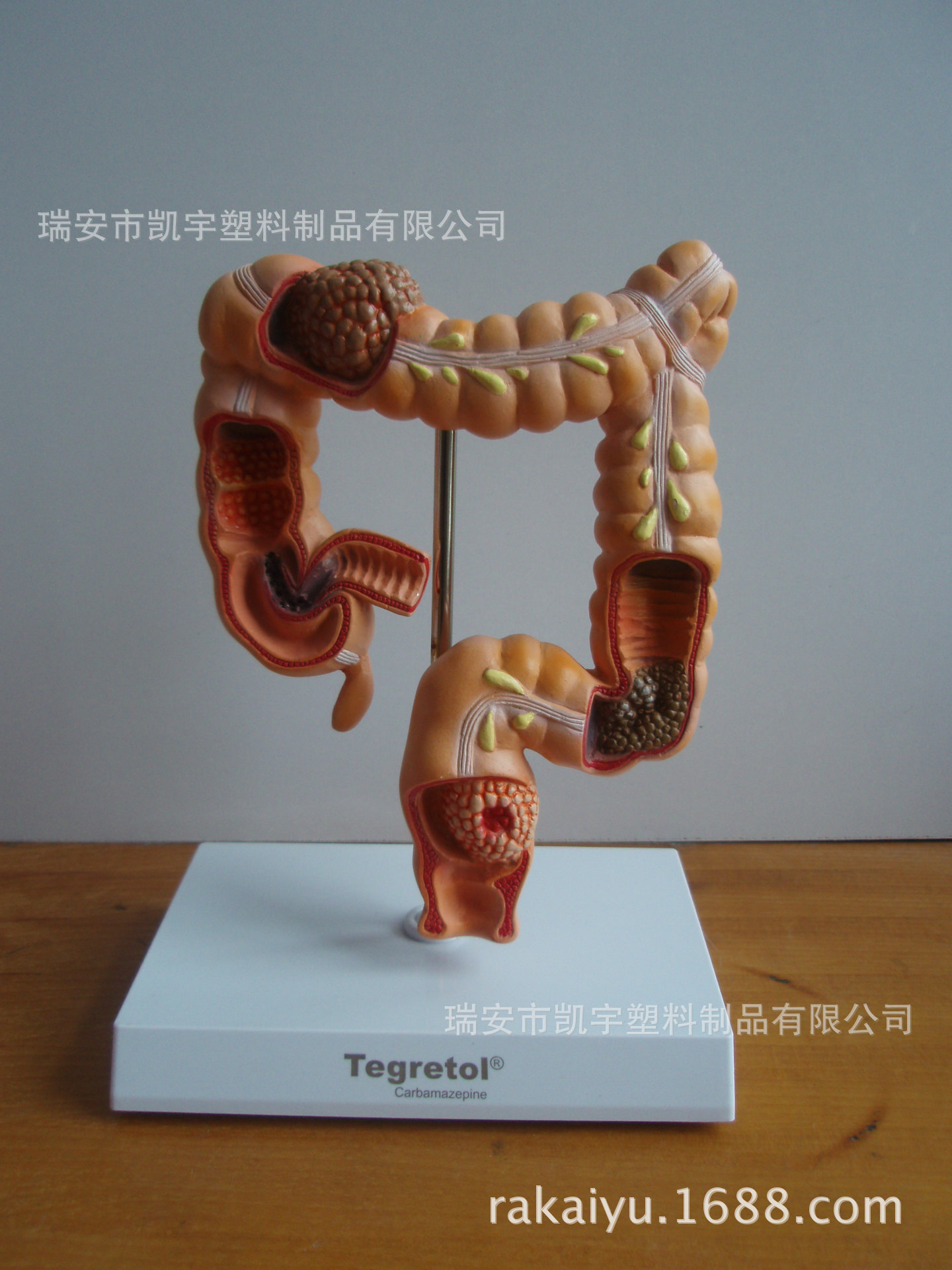 供应大肠变病模型/教学模型/器官模型/医学模型