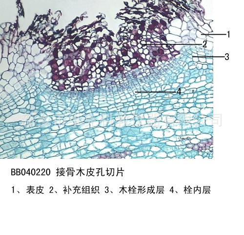 接骨木皮孔切片 生物切片 植物类装片 茎及茎的变态 显微镜专用