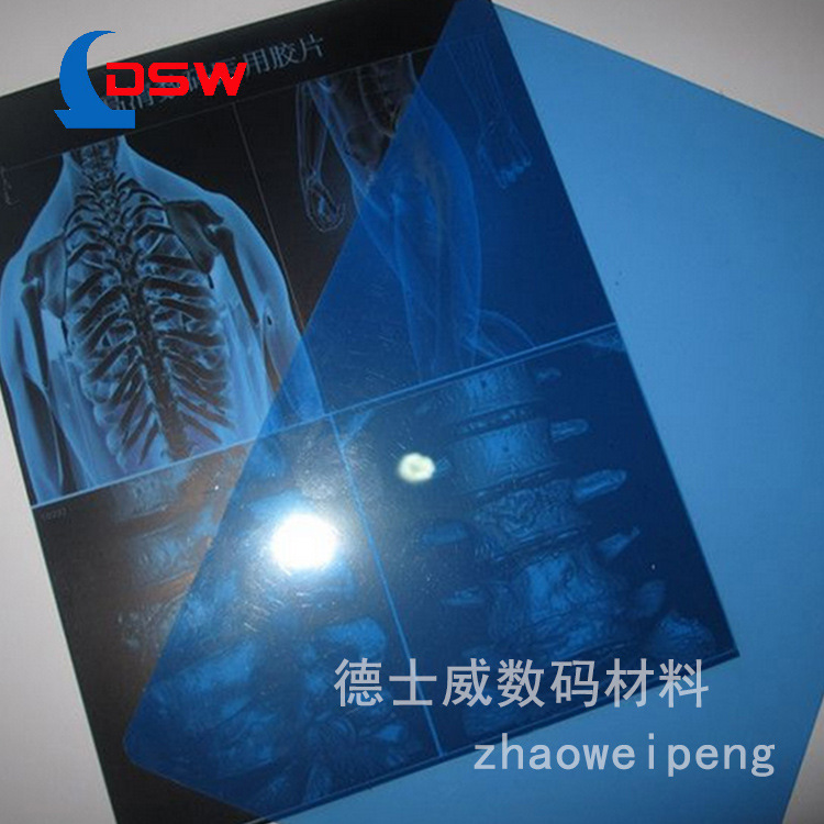 藍(lán)基醫(yī)用干式膠片 (2)