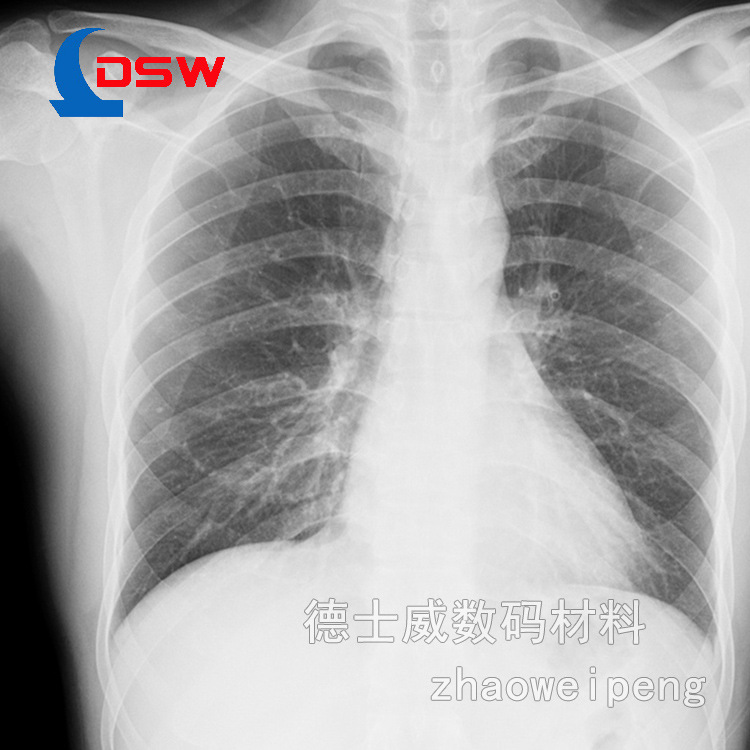 藍(lán)基醫(yī)用干式膠片 (4)