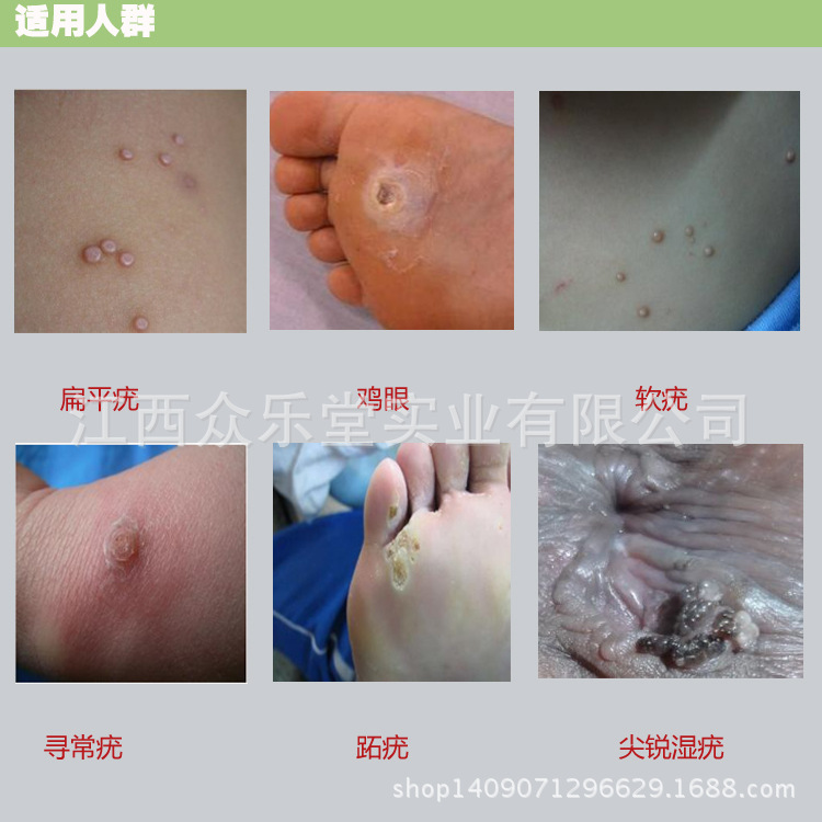 众乐堂承接各类消毒剂,凝胶,润滑剂,外用软膏,脚气喷剂,风湿,妇科洗液