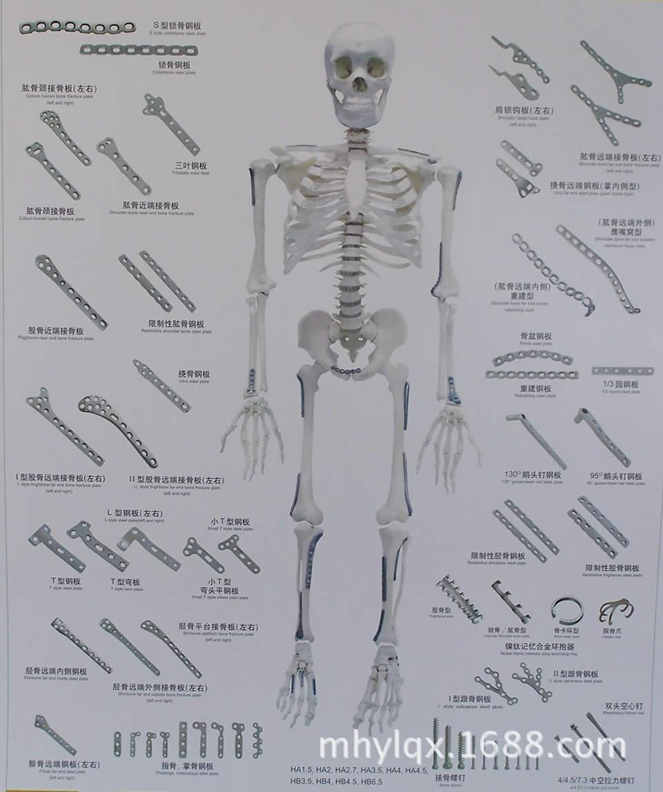 批发成套天津人立骨科器械/固定针器械