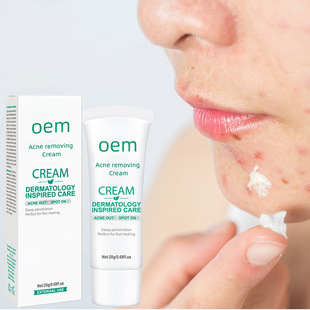 Acne cream᝙wo̝˪owƷoemƼӹ