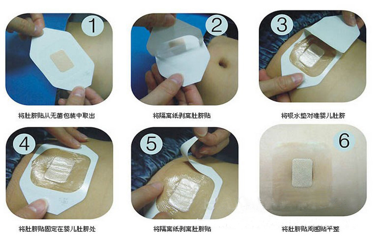 肚脐保护带使用方法图图片