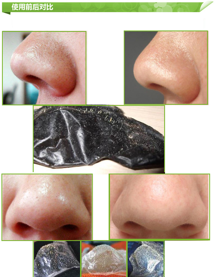 正品 歌柔 纯中药吸黑头鼻膜 强力吸黑头 鼻贴膜 中华百草