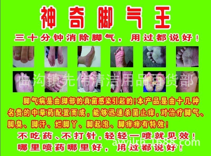 脚气神油,脚气水,脚气水喷剂,一喷见效的神奇多功能脚气水