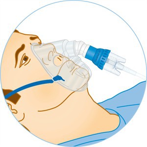 一次性使用雾化面罩及管路,口含型,可作雾化的同时,接呼吸机