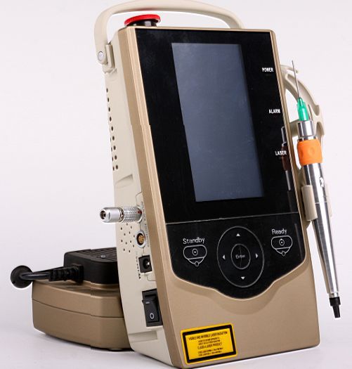 口腔激光治疗仪的机理和5个特点